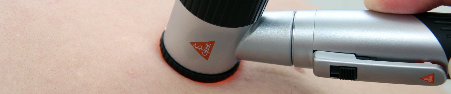 Hautcheck mit Auflichtmikroskopie